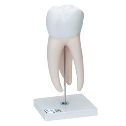 3B Scientific Giant Molar with Cavity, Item Number 2091084