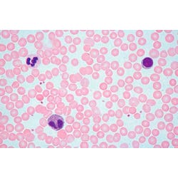 Johannes Lieder Human Histology Standard Prepared Slides, Set of 25, Item Number 581428