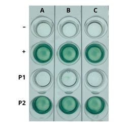 AIDS Kit I: Simulation of HIV Detection by ELISA 2134035