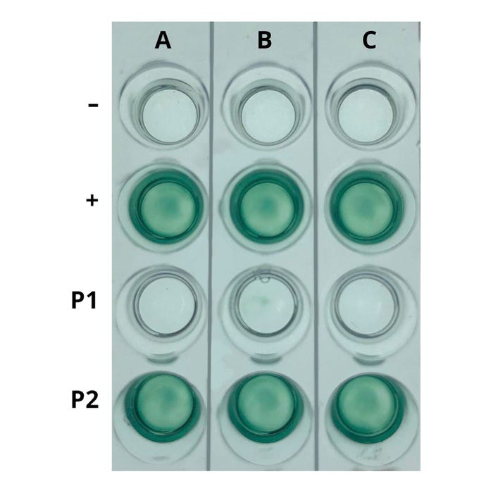 Edvotek AIDS Kit I: Simulation of HIV Detection by ELISA