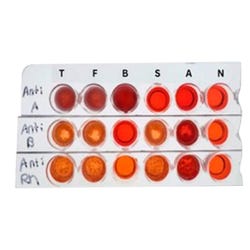 Edvotek Matchmakers in Medicine Kidney Transplant Compatibility Experiment