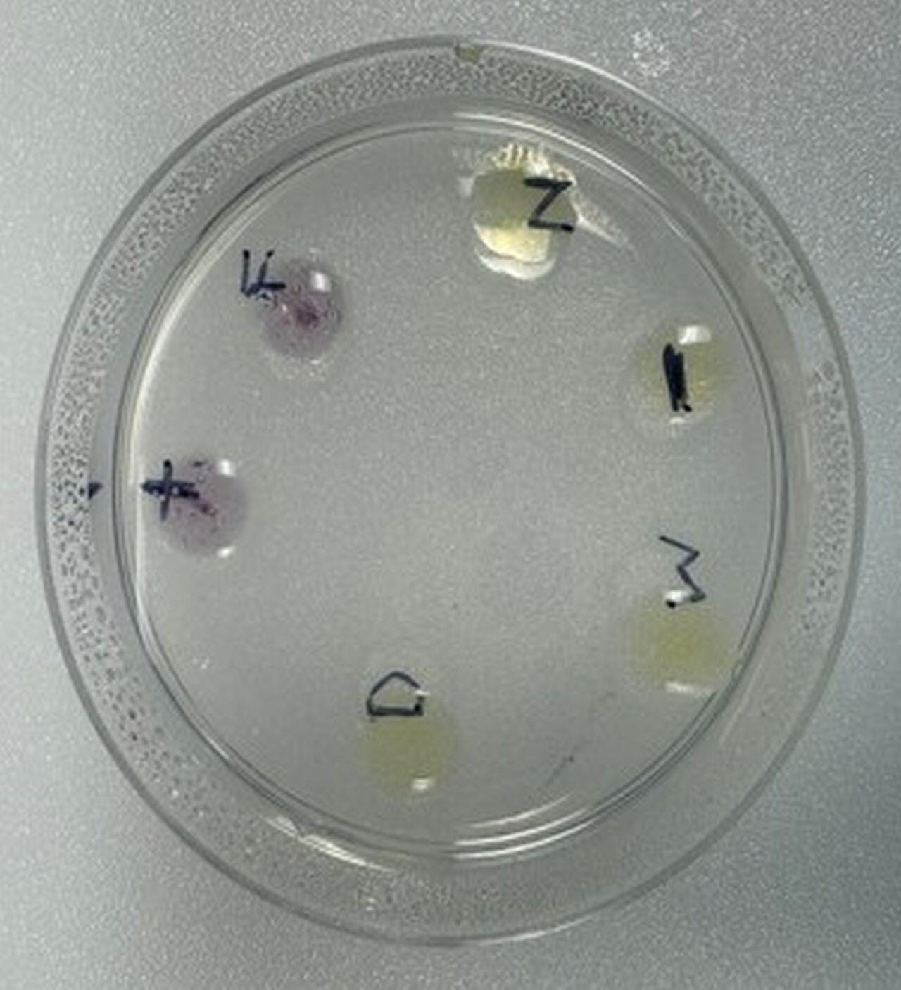 Edvotek Immune Clues Diagnosing Allergic Reactions for 10 Lab Groups