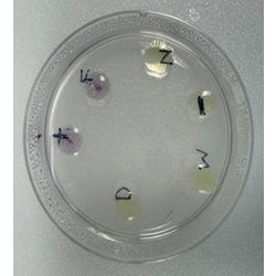 Edvotek Immune Clues Diagnosing Allergic Reactions for 10 Lab Groups