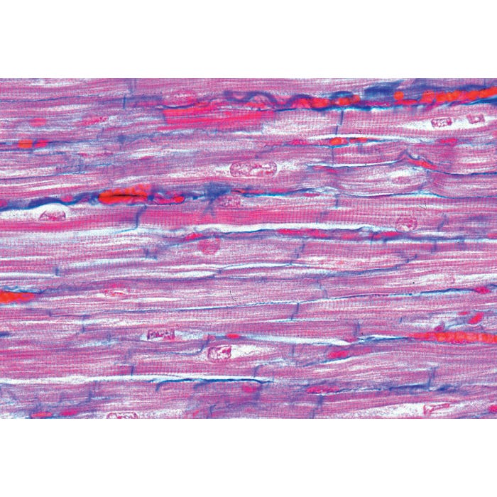 Johannes Lieder Prepared Microscope Slides, Human Muscle, Set of 3