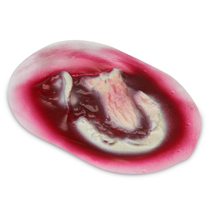 Wound - Avulsion - Stick-On - Major - 8 x 5 cm