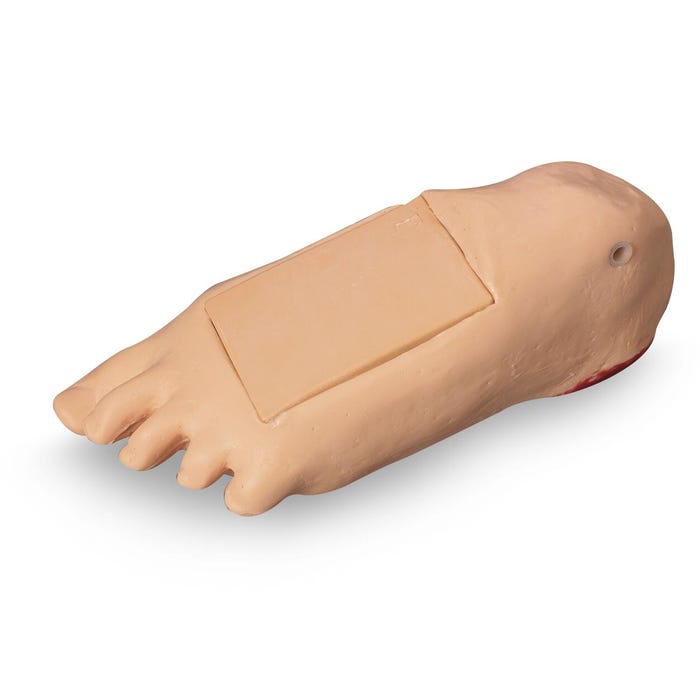 Life/form® GERi™ and KERi™ Optional Edema Foot with Deep Tissue Injury - Light