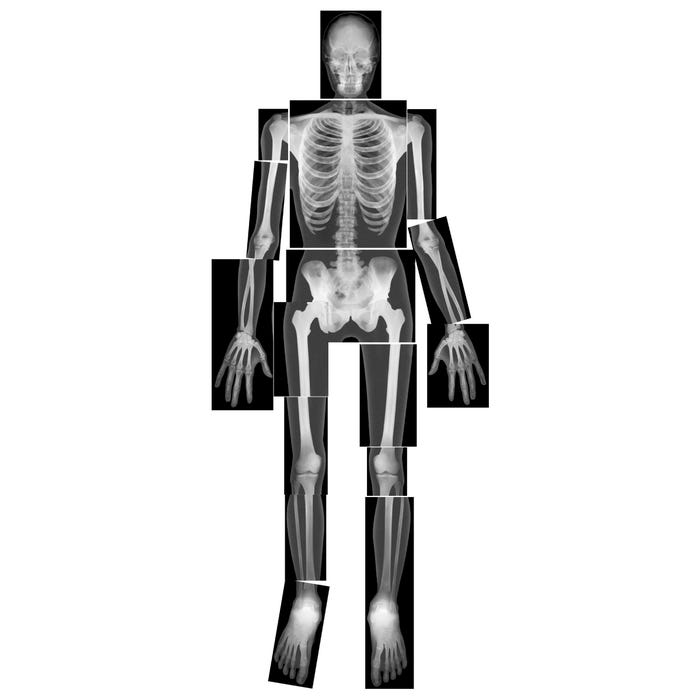 Roylco True to Life Human X-Rays - Set of 18