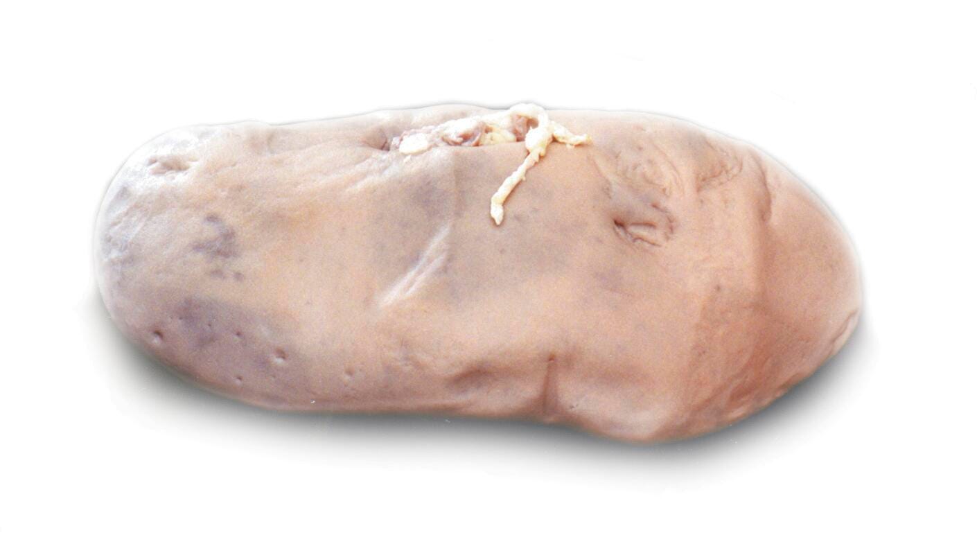 Frey Choice Preserved Pig Organs, Kidneys, Double Injected, Pack of 10, Item Number 596895
