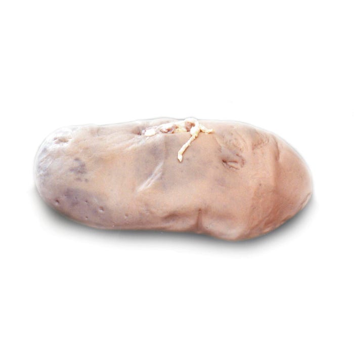 Frey Scientific Choice Preserved Pig Kidneys, Double Injected, Vacuum Sealed Pack of 10