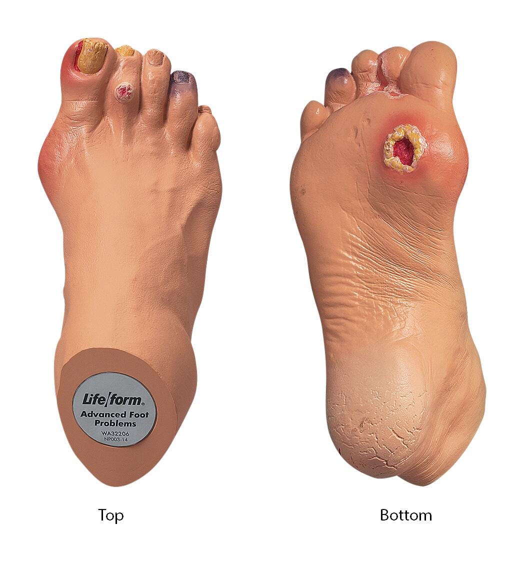 Nasco Advanced Foot Problems Replica