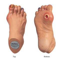 Nasco Advanced Foot Problems Replica