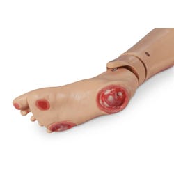 Life/form GERi/KERi Optional Pressure Injury Foot, Light