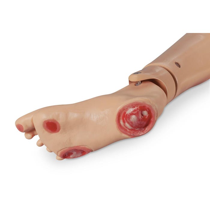 Life/form® GERi™/KERi™ Optional Pressure Injury Foot - Light
