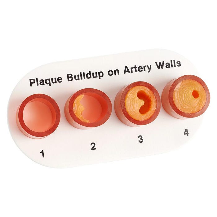 Nasco Healthcare Artery Section with Blockage Model