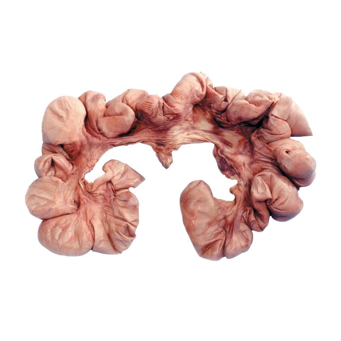 Frey Scientific Choice Preserved Pig Uterus with Embryo, Vacuum Sealed