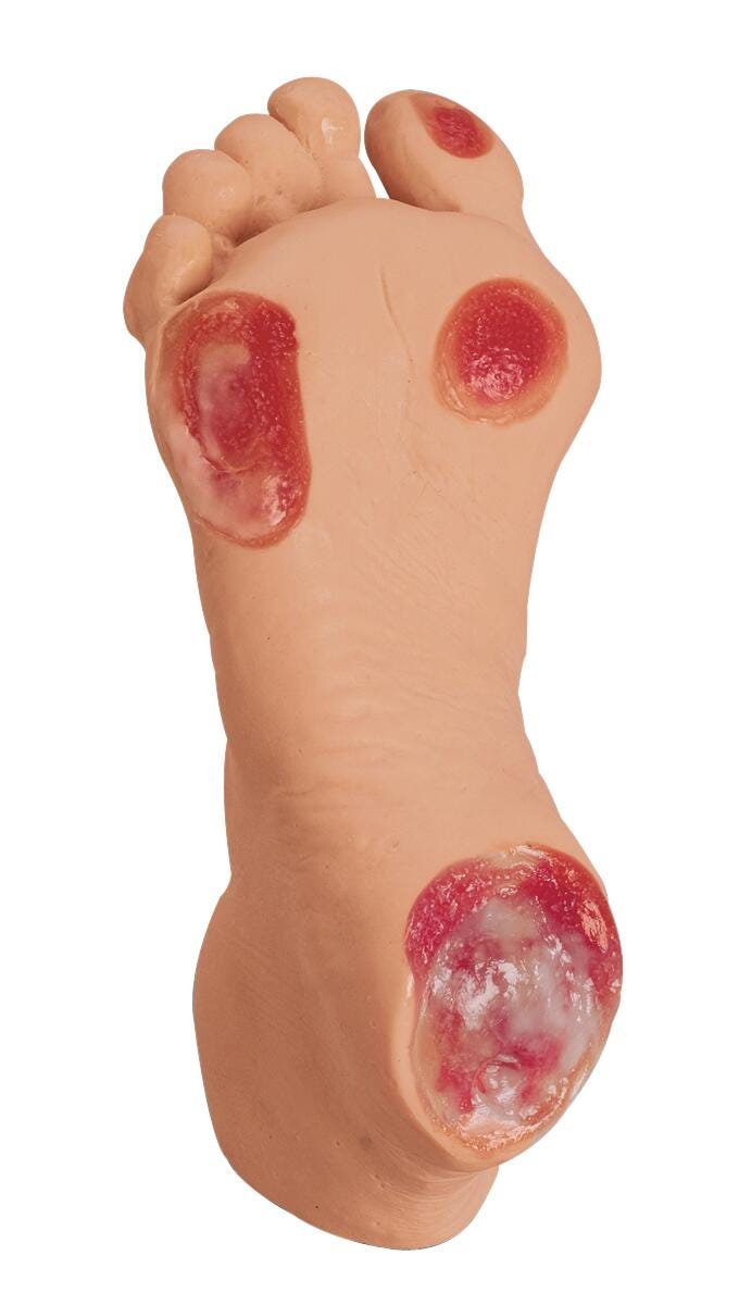 Life/form® Elderly Pressure Ulcer Foot - Light