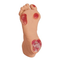 Life/form Elderly Pressure Ulcer Foot, Light