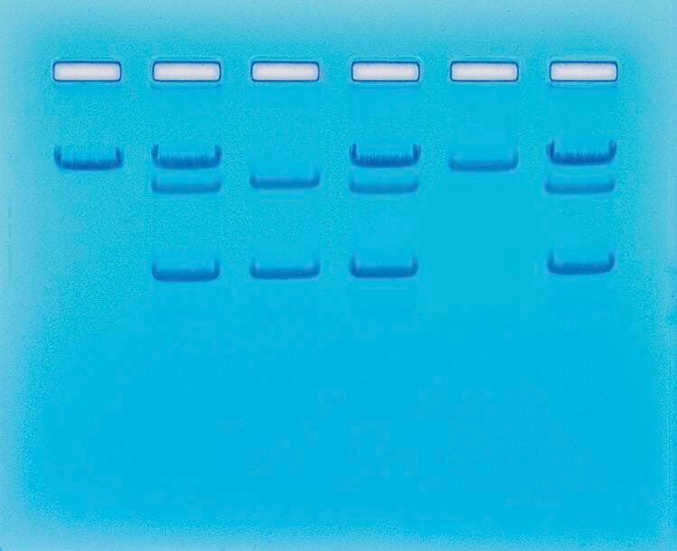 Sickle Cell Gene Detection (DNA-based) 2134037