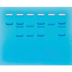 Sickle Cell Gene Detection (DNA-based) 2134037