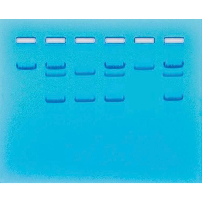 Edvotek Sickle Cell Gene Detection Kit (DNA-based)