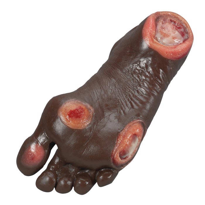Life/form Elderly Pressure Ulcer Foot, Dark