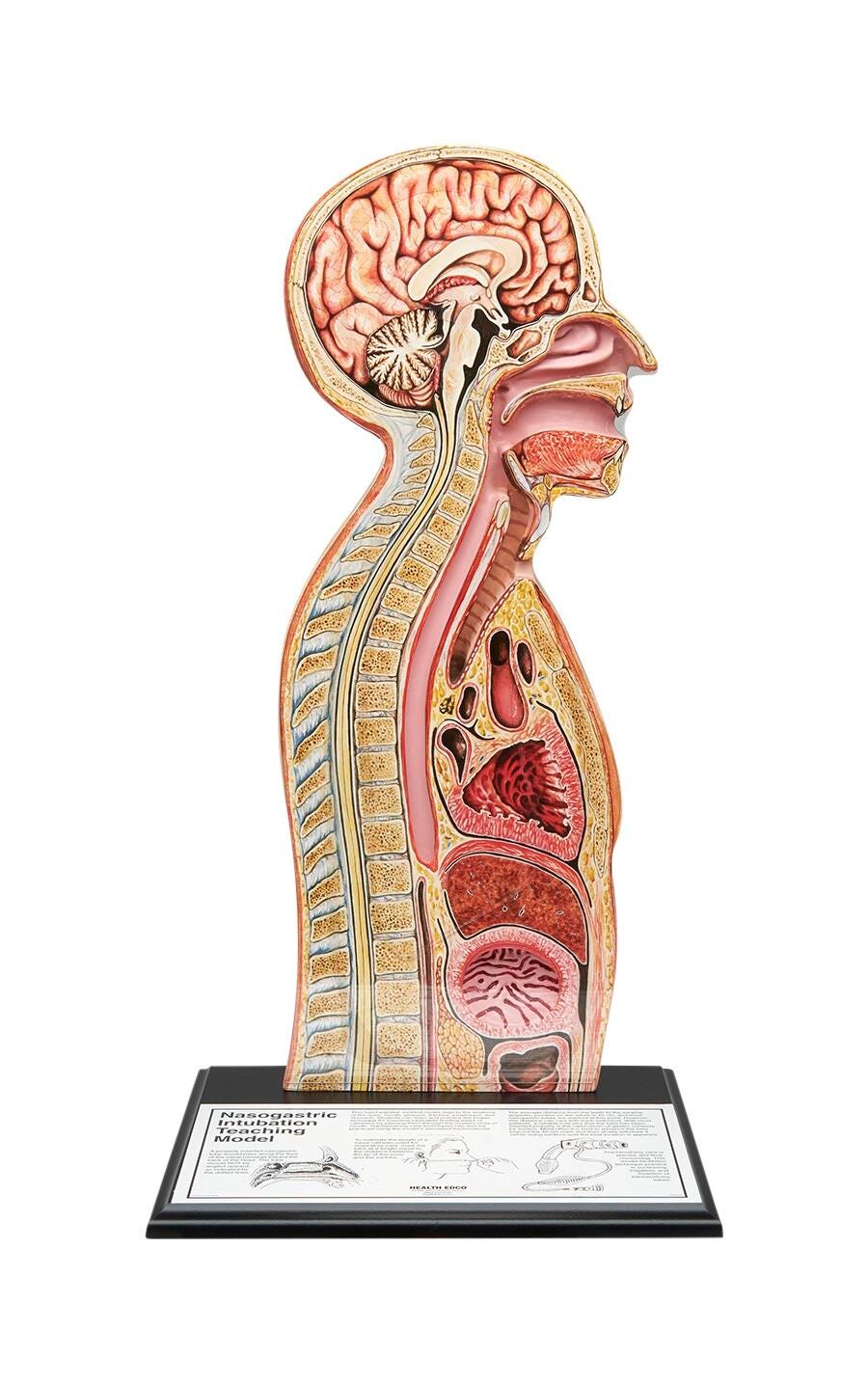 Image for Nasogastric Tube Feeding Model from School Specialty