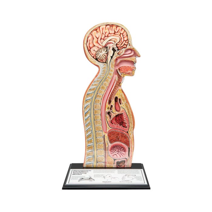 Nasogastric Tube Feeding Model