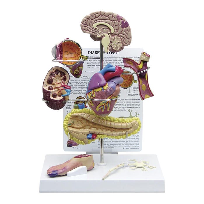 Gpi Anatomicals Type 2 Diabetes Models, 10 Inches