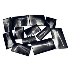 Roylco Fixed Bones X-rays, Item Number 2103921