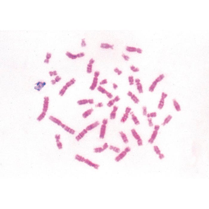 Johannes Lieder Prepared Microscope Slide, Basic Bacteria, Set of 25