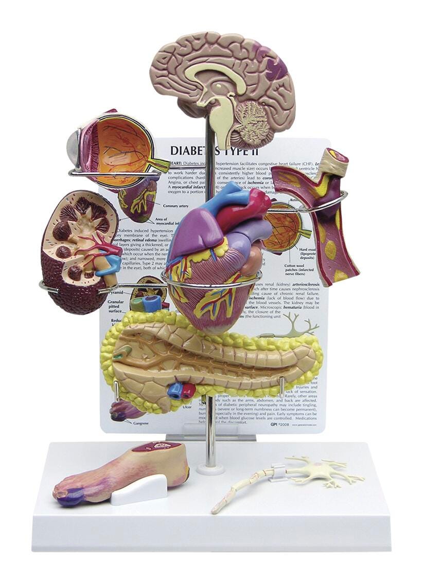 Image for Type 2 Diabetes Models from School Specialty