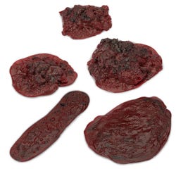 Life/form Clots and Hemorrhages, Set of 5
