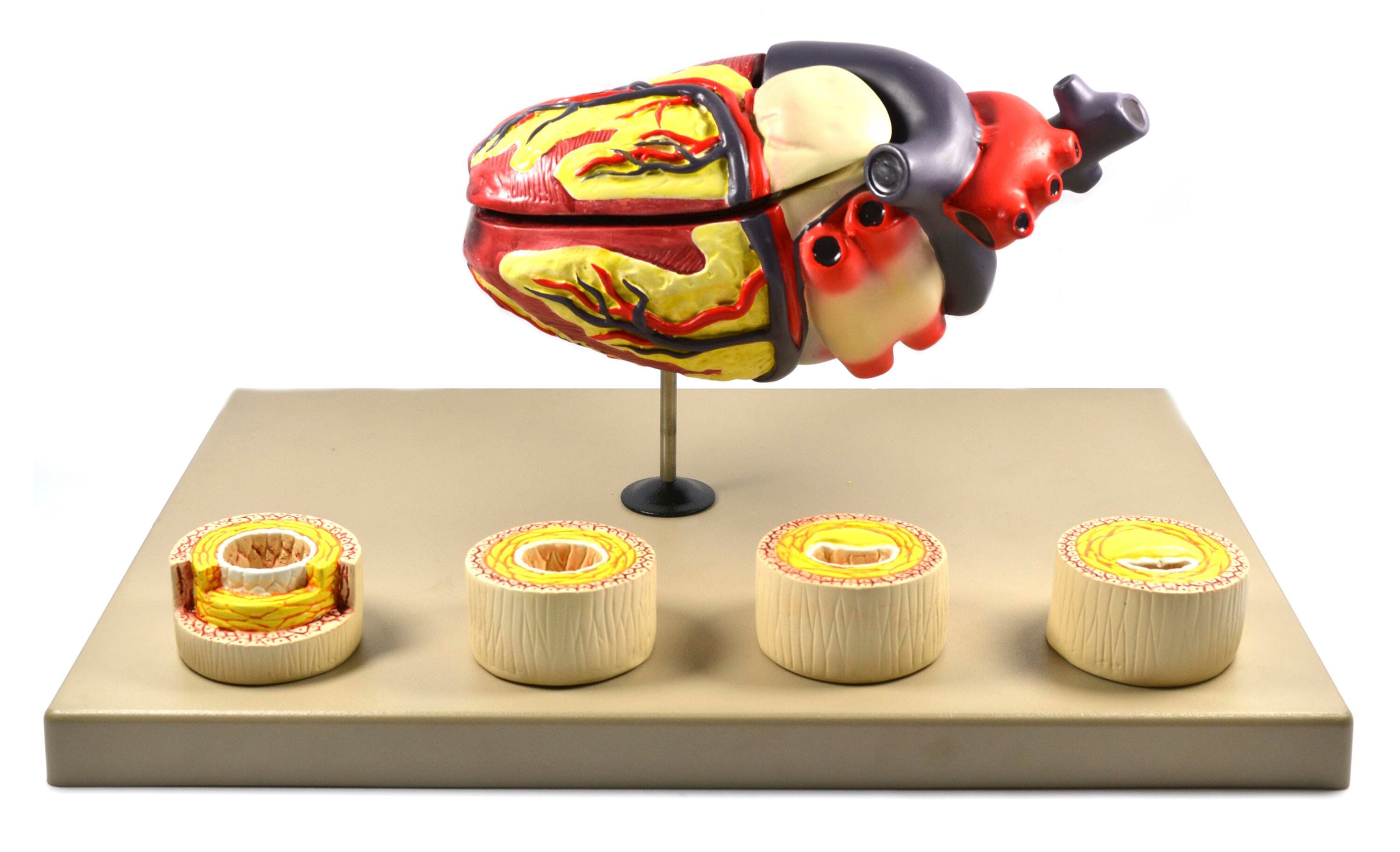 Eisco Labs Model of Human Heart Conditions Pathology 2144628
