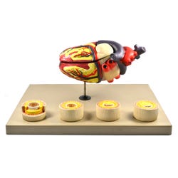 Eisco Labs Model of Human Heart Conditions Pathology 2144628
