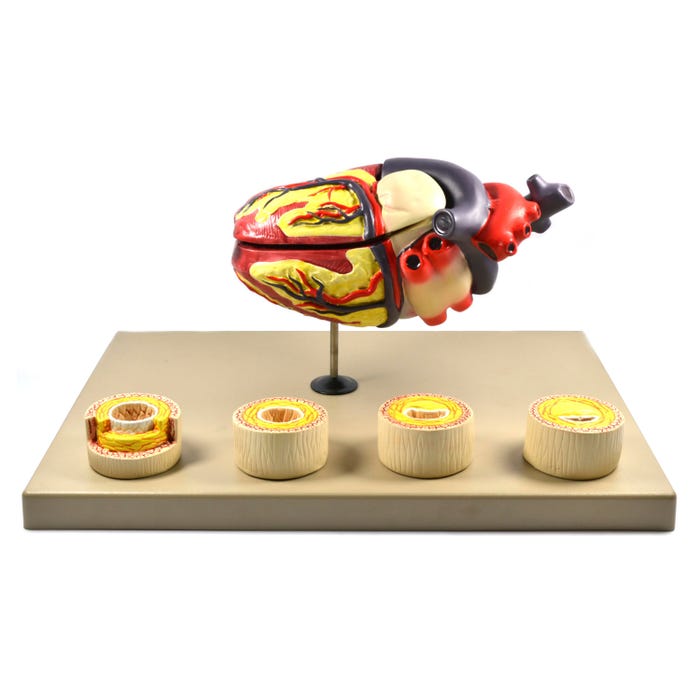 Eisco Labs Model of Human Heart Conditions Pathology