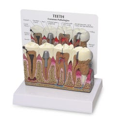 Teeth Model - 5-1/2 in. x 2 in. x 3-1/2 in.