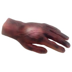 Burn Hand 2Nd & 3Rd Degree