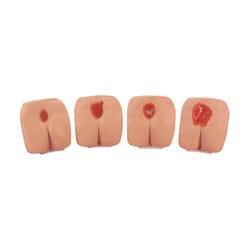 Life/form Pressure Ulcer/Bedsore Models, Light, Set of 4