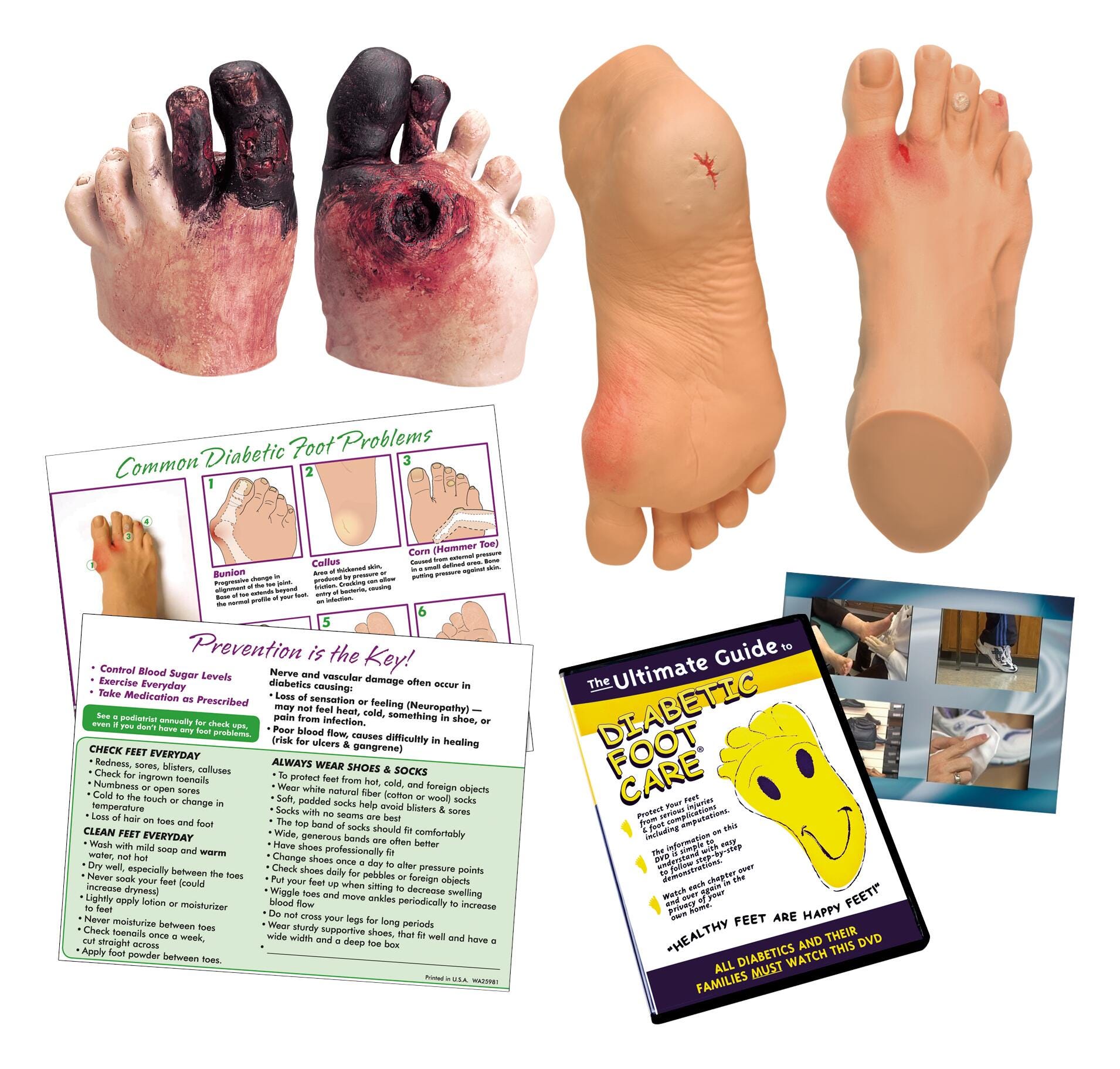 Life/from Diabetic Foot Care Education Kit