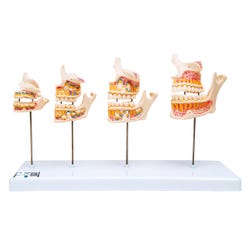 3B Scientific Dentition Development