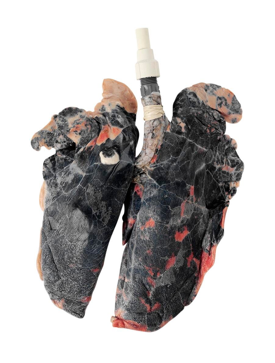 Image for Nasco Inflatable Simulated Smoker's Lungs from School Specialty