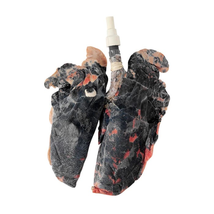Nasco Replacement Set for Inflatable Smoker's Lungs Demonstration Kit