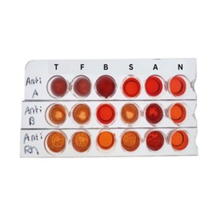 Edvotek Matchmakers in Medicine Kidney Transplant Compatibility Experiment