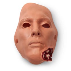 Jaw Wound, Bleeding