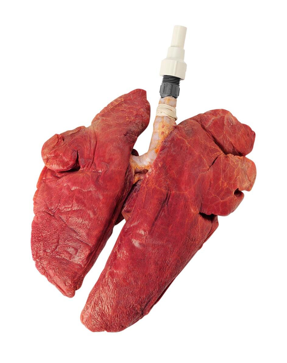 Image for Nasco Inflatable Healthy Lungs Only from School Specialty