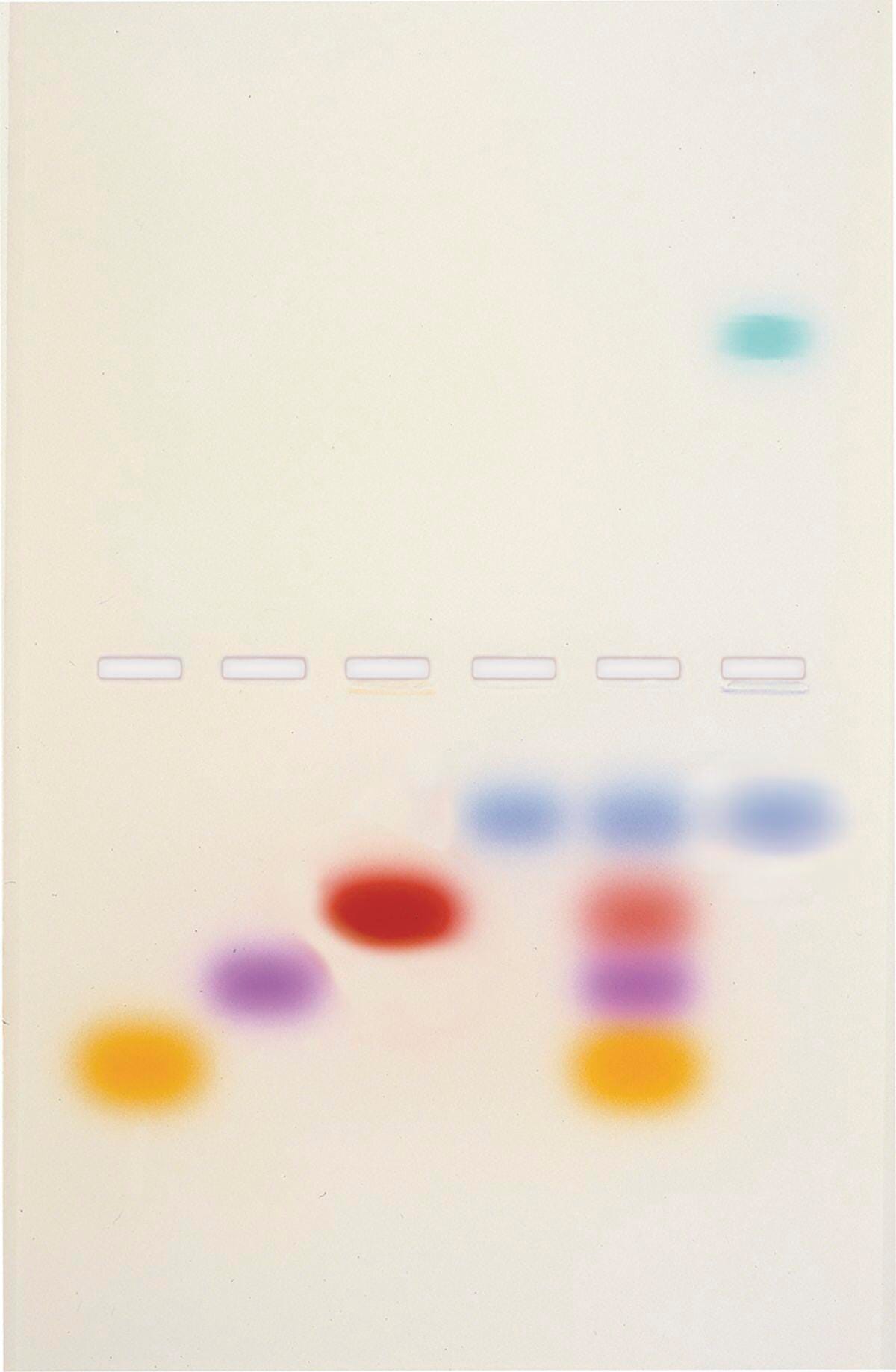 Principles and Practice of Agarose Gel Electrophoresis 2134041