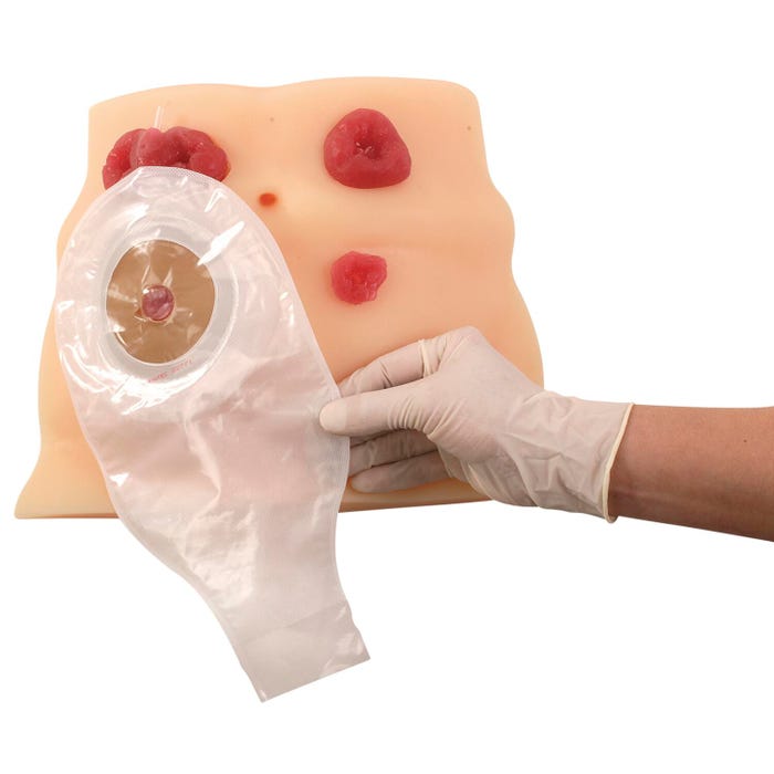 Health Edco Ostomy Care Model, 11 x 7-3/4 x 3-1/2 Inches