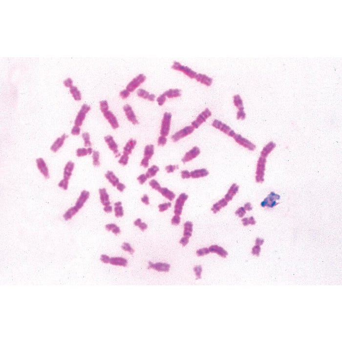 Johannes Lieder Prepared Microscope Slide, General Biology Set D, Set of 50