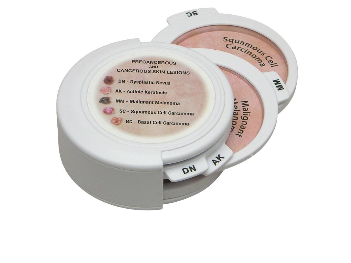 GPI Anatomicals Hinged Skin Cancer Disks, 4 Inches Dia., Set of 5