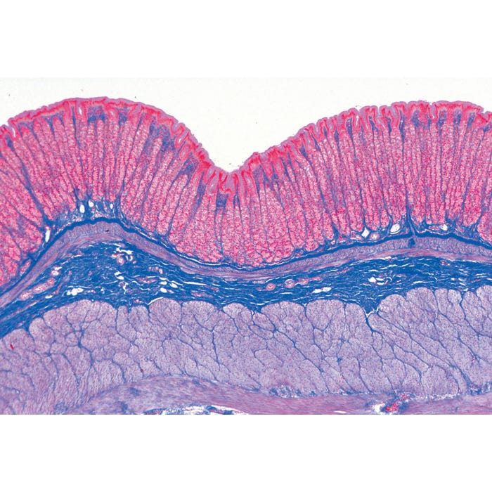 Johannes Lieder Prepared Microscope Slides, Beginner Human Tissue, Set of 15